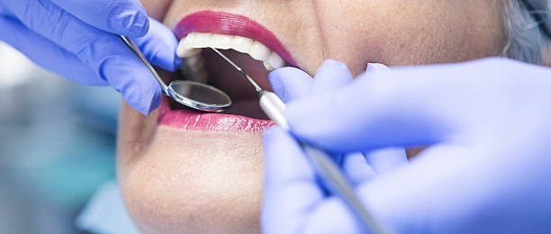 Best Emergency Dental Services for Seniors in Panama City, FL
